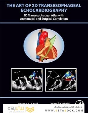 The Art of 2D Transesophageal Echocardiography 1st Edition