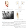 Textbook of Endodontics 5th Edition