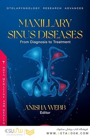 Maxillary Sinus Diseases: From Diagnosis to Treatment