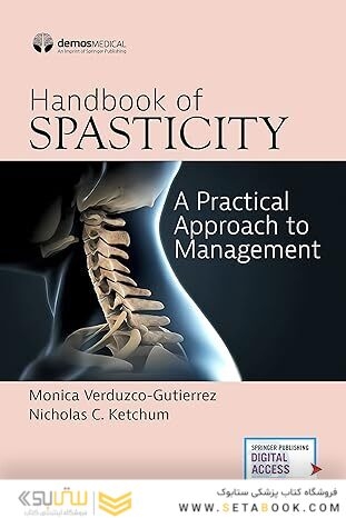Handbook of Spasticity: A Practical Approach to Management 1st Edition
