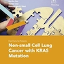 Non-small Cell Lung Cancer With Kras Mutation