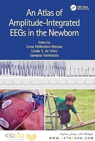 An Atlas of Amplitude-Integrated EEGs in the Newborn 3rd Edition