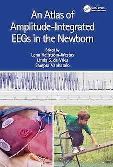 عکس An Atlas of Amplitude-Integrated EEGs in the Newborn 3rd Edition