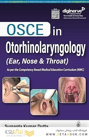 OSCE in Otorhinolaryngology