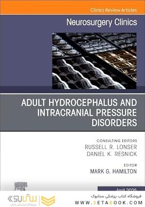 Adult Hydrocephalus and Intracranial Pressure Disorders, An Issue of Neurosurgery Clinics of North America