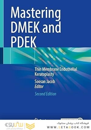 Mastering DMEK and PDEK: Thin Membrane Endothelial Keratoplasty Second Edition
