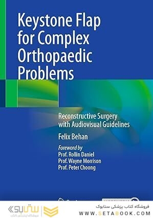 Keystone Flap for Complex Orthopaedic Problems: Reconstructive Surgery with Audiovisual Guidelines