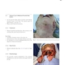 Head and Neck Reconstructive Surgery: A Comprehensive Clinical Case Guide