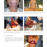 Head and Neck Reconstructive Surgery: A Comprehensive Clinical Case Guide