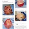 Head and Neck Reconstructive Surgery: A Comprehensive Clinical Case Guide