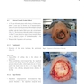 Head and Neck Reconstructive Surgery: A Comprehensive Clinical Case Guide