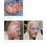 Head and Neck Reconstructive Surgery: A Comprehensive Clinical Case Guide