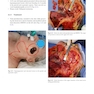 Head and Neck Reconstructive Surgery: A Comprehensive Clinical Case Guide