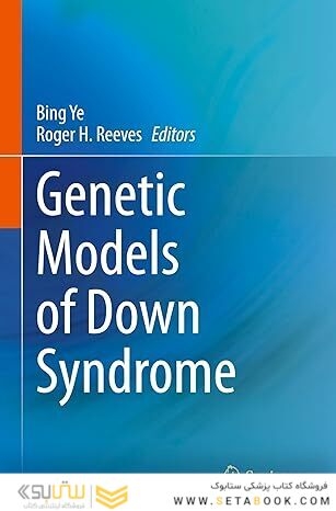 Genetic Models of Down Syndrome
