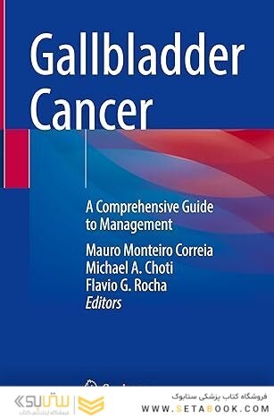 Gallbladder Cancer: A Comprehensive Guide to Management