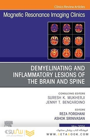 Demyelinating and Inflammatory Lesions of the Brain and Spine, An Issue of Magnetic Resonance Imaging Clinics of North America