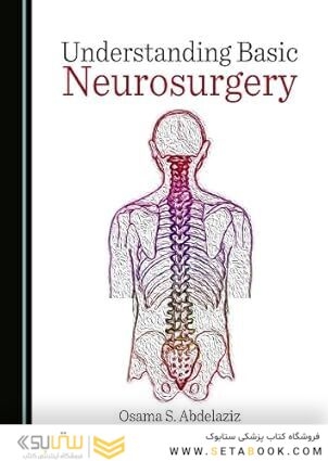 Understanding Basic Neurosurgery