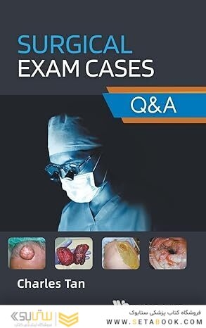 Surgical Exam Cases: Q&A