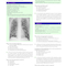 Comprehensive Self-Assessment in Infectious Disease: Questions and Answers: Questions and Answers 1st Edition