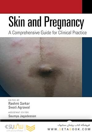 Skin and Pregnancy: A Comprehensive Guide for Clinical Practice 1st Edition