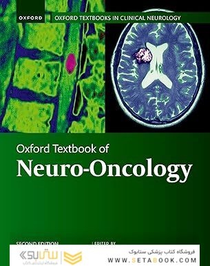 Oxford Textbook of Neuro-Oncology
