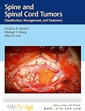 Spine and Spinal Cord Tumors: Classification, Management, and Treatment 1st Edition