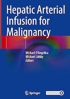 عکس Hepatic Arterial Infusion for Malignancy