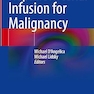 Hepatic Arterial Infusion for Malignancy