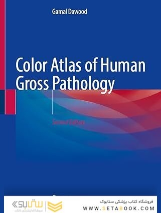 Color Atlas of Human Gross and Microscopic Pathology Second Edition