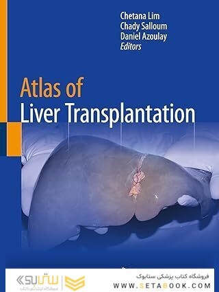 Atlas of Liver Transplantation