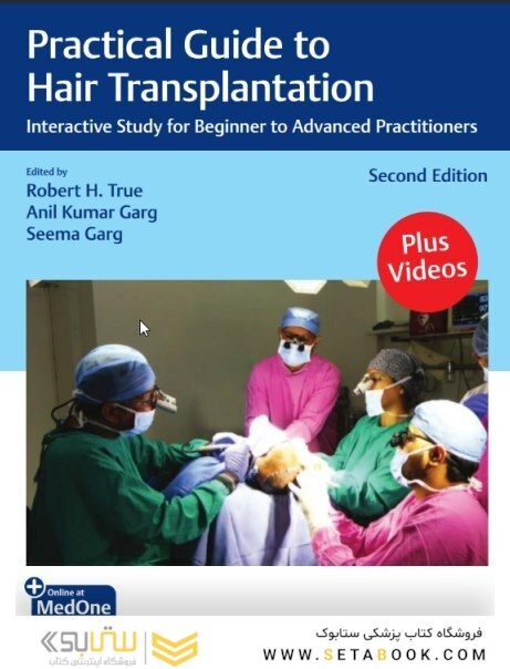Practical Guide to Hair Transplantation Interactive Study for Beginner to Advanced