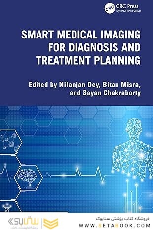 Smart Medical Imaging for Diagnosis and Treatment Planning 1st Edition