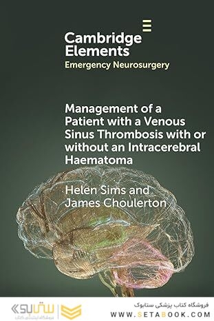 Management of a Patient with a Venous Sinus Thrombosis with or without an Intracerebral Haematoma