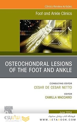 Osteochondral Lesions of the Foot and Ankle, An issue of Foot and Ankle Clinics of North America
