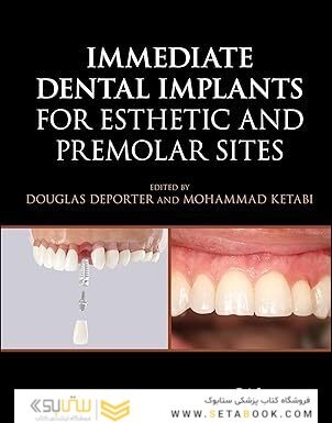 Immediate Dental Implants for Esthetic and Premolar Sites 1st Edition