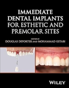 عکس Immediate Dental Implants for Esthetic and Premolar Sites 1st Edition