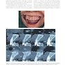 Immediate Dental Implants for Esthetic and Premolar Sites 1st Edition
