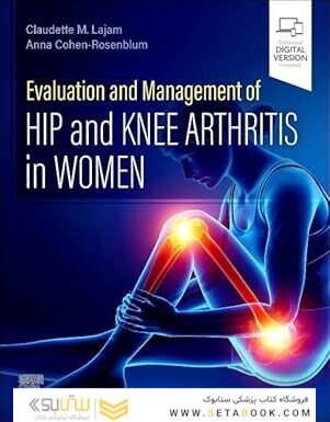 Evaluation and Management of Hip and Knee Arthritis in Women 1st Edition