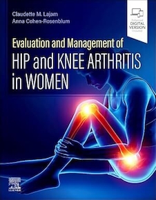 عکس Evaluation and Management of Hip and Knee Arthritis in Women 1st Edition