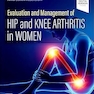 Evaluation and Management of Hip and Knee Arthritis in Women 1st Edition
