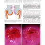 Colposcopy: Comprehensive Textbook and Atlas 1st ed