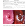 Colposcopy: Comprehensive Textbook and Atlas 1st ed