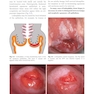 Colposcopy: Comprehensive Textbook and Atlas 1st ed