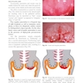 Colposcopy: Comprehensive Textbook and Atlas 1st ed