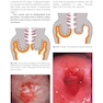 Colposcopy: Comprehensive Textbook and Atlas 1st ed