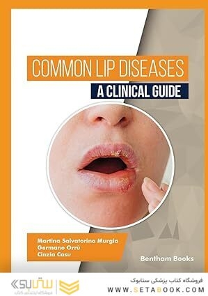 Common Lip Diseases: A Clinical Guide