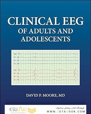 Clinical EEG of Adults and Adolescents 1st Edition