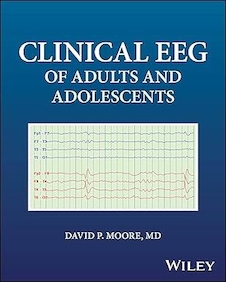 عکس Clinical EEG of Adults and Adolescents 1st Edition