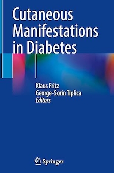 عکس Cutaneous Manifestations in Diabetes