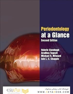 Wiley-Blackwell Periodontology at a Glance